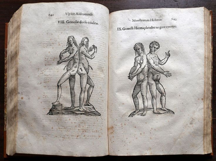 1280px-ulisse_aldrovandi2c_monstrorum_historia2c_per_nicola_tebaldini2c_bologna_16422c_220_gemelli_siamesi